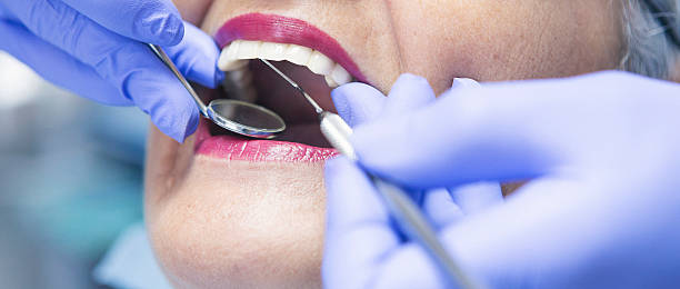 Best Emergency Gum Treatment in Benld, IL